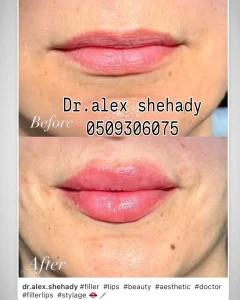 YOPPA.CO.IL - דר אלכס שחאדה מרפאת שיניים (1)