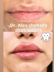 YOPPA.CO.IL - דר אלכס שחאדה מרפאת שיניים (4)