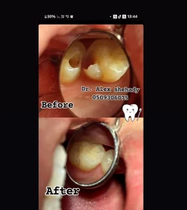 YOPPA.CO.IL - דר אלכס שחאדה מרפאת שיניים (7)