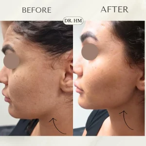 דר חנא מחול רפואה אסתטית (2)