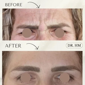 דר חנא מחול רפואה אסתטית (3)