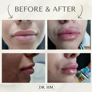 דר חנא מחול רפואה אסתטית (4)