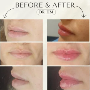 דר חנא מחול רפואה אסתטית (5)