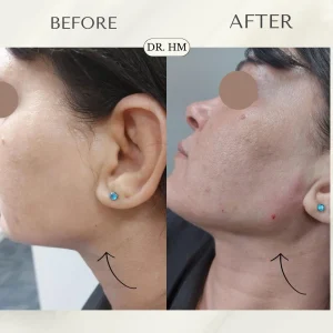 דר חנא מחול רפואה אסתטית (7)